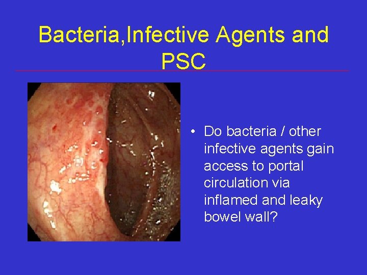 Bacteria, Infective Agents and PSC • Do bacteria / other infective agents gain access Bacteria, Infective Agents and PSC • Do bacteria / other infective agents gain access