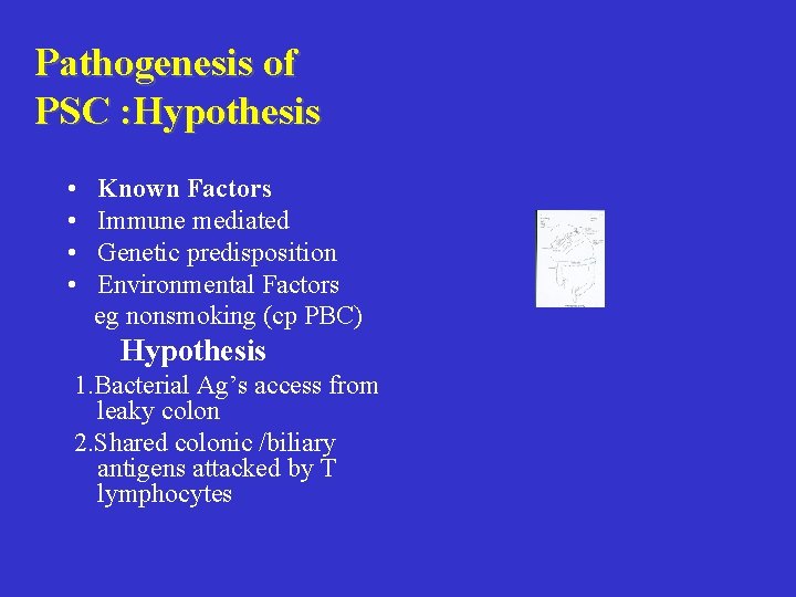 Pathogenesis of PSC : Hypothesis • • Known Factors Immune mediated Genetic predisposition Environmental Pathogenesis of PSC : Hypothesis • • Known Factors Immune mediated Genetic predisposition Environmental