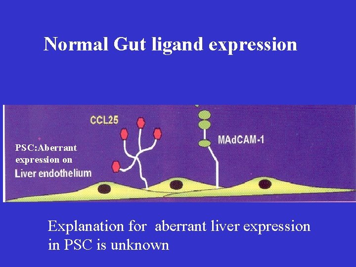 Normal Gut ligand expression PSC: Aberrant expression on Explanation for aberrant liver expression in Normal Gut ligand expression PSC: Aberrant expression on Explanation for aberrant liver expression in