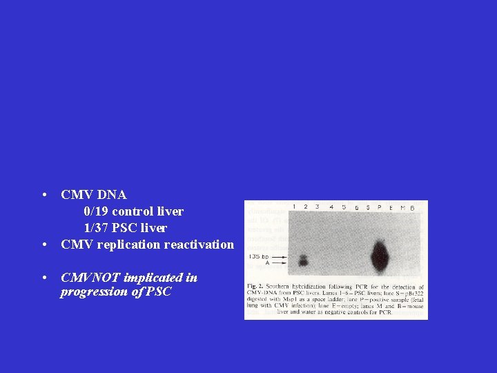 • CMV DNA 0/19 control liver 1/37 PSC liver • CMV replication reactivation • CMV DNA 0/19 control liver 1/37 PSC liver • CMV replication reactivation