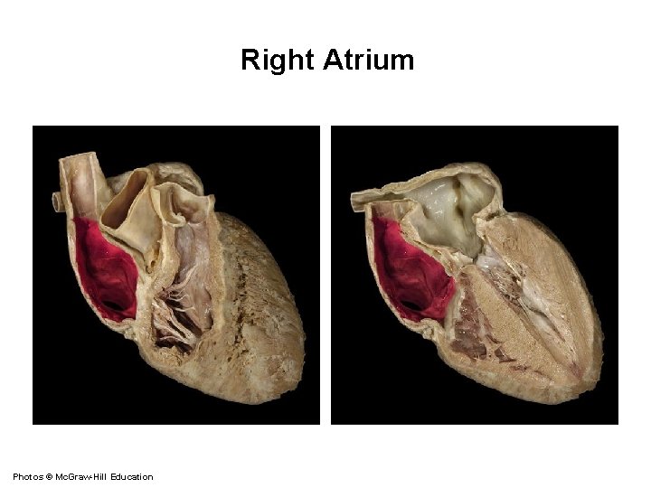 Right Atrium Photos © Mc. Graw-Hill Education 