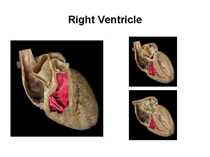 Right Ventricle Photos © Mc. Graw-Hill Education Papillary muscles Interventricular septum Trabeculae carne 