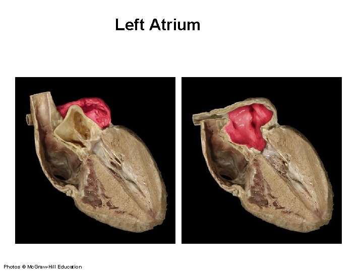 Left Atrium Photos © Mc. Graw-Hill Education 