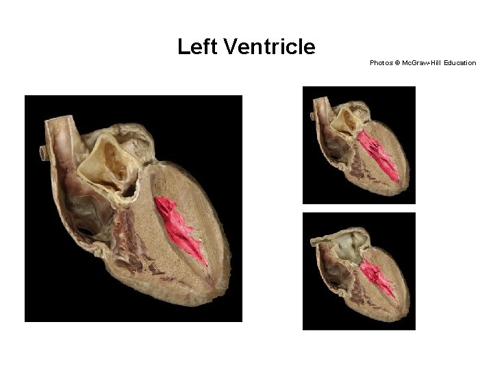Left Ventricle Photos © Mc. Graw-Hill Education 