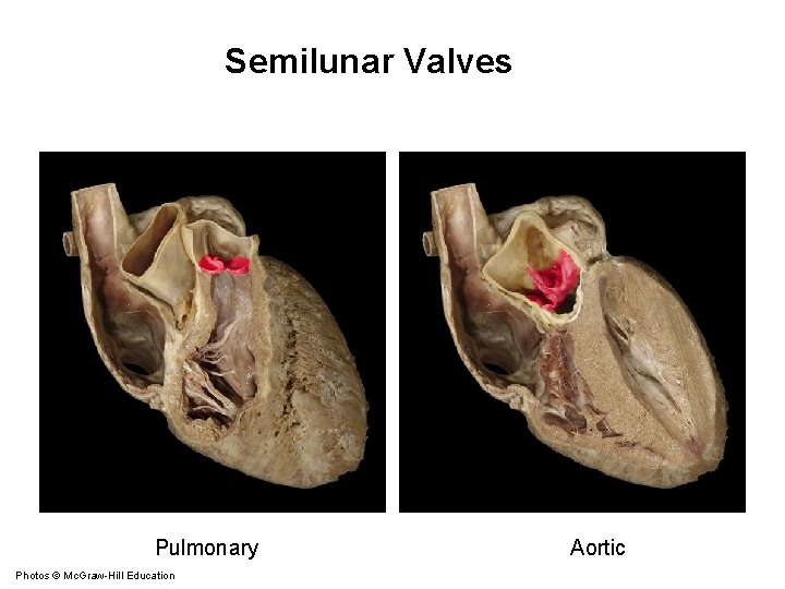 Semilunar Valves Pulmonary Photos © Mc. Graw-Hill Education Aortic 