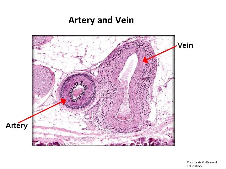 Artery and Vein Artery Photos © Mc. Graw-Hill Education 