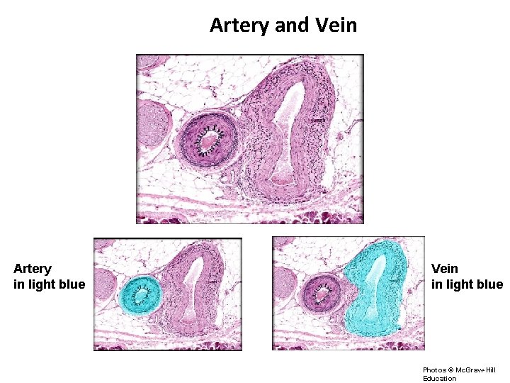 Artery and Vein Artery in light blue Vein in light blue Photos © Mc.