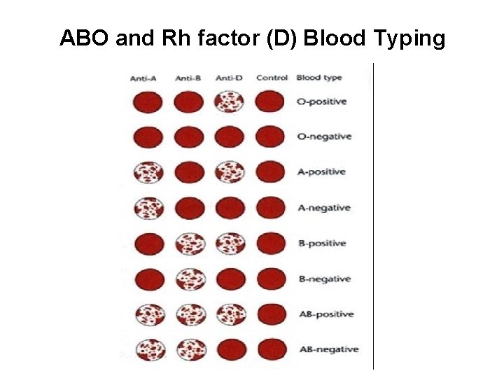 ABO and Rh factor (D) Blood Typing 