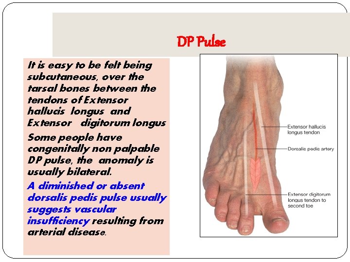 DP Pulse It is easy to be felt being subcutaneous, over the tarsal bones