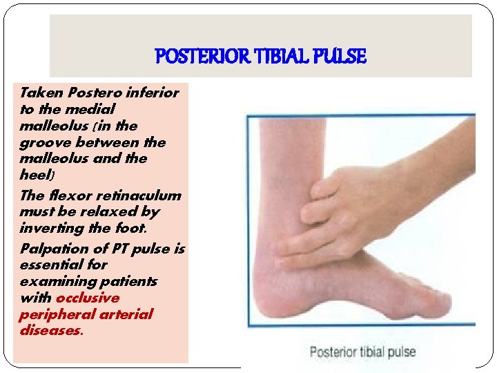 POSTERIOR TIBIAL PULSE Taken Postero inferior to the medial malleolus (in the groove between