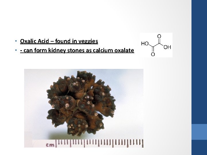  • Oxalic Acid – found in veggies • - can form kidney stones