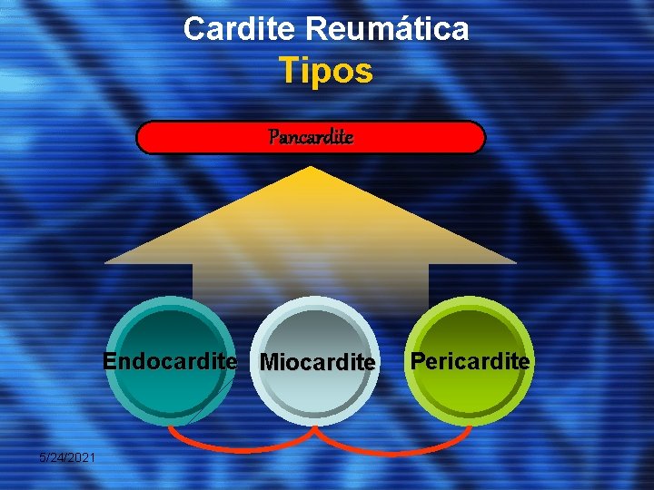 Cardite Reumática Tipos Pancardite Endocardite Miocardite 5/24/2021 Pericardite 