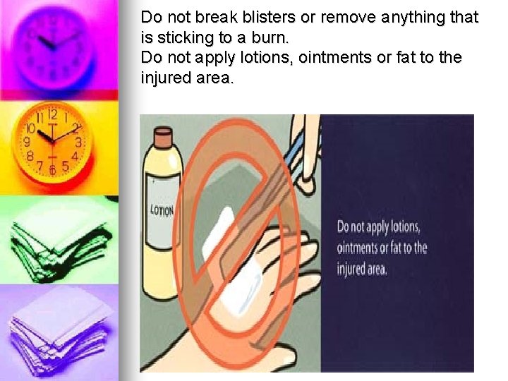 Do not break blisters or remove anything that is sticking to a burn. Do