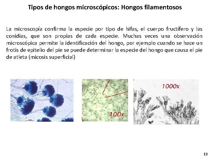 Tipos de hongos microscópicos: Hongos filamentosos La microscopía confirma la especie por tipo de
