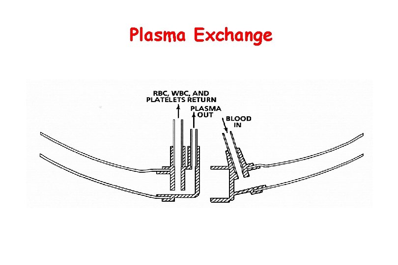 Plasma Exchange 