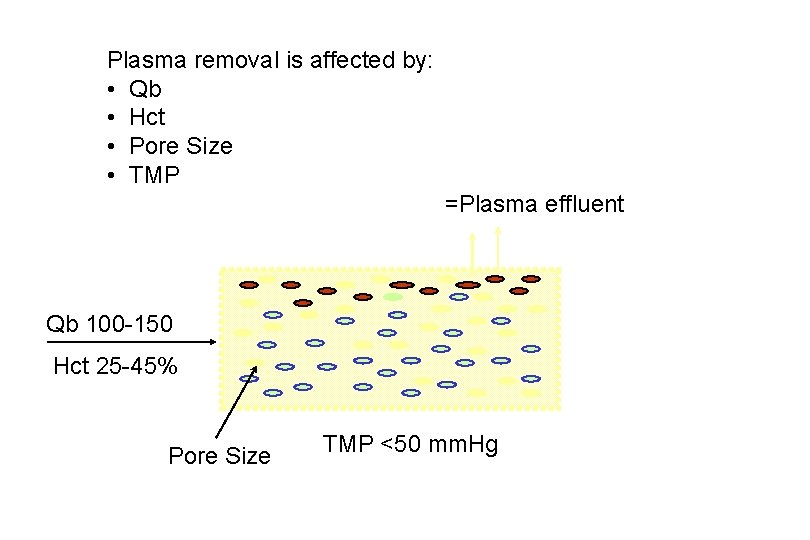 Plasma removal is affected by: • Qb • Hct • Pore Size • TMP