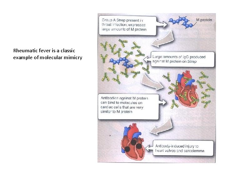 Rheumatic fever is a classic example of molecular mimicry 