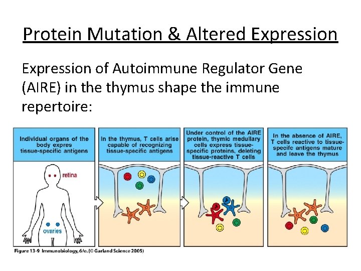 Protein Mutation & Altered Expression of Autoimmune Regulator Gene (AIRE) in the thymus shape