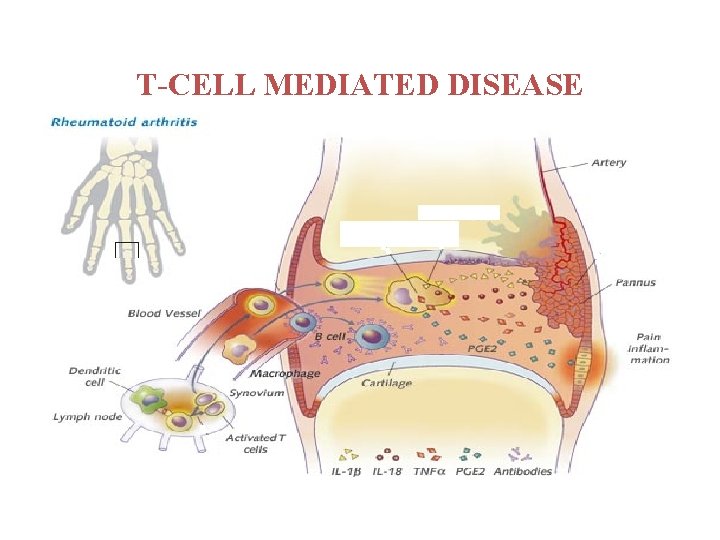 T-CELL MEDIATED DISEASE 