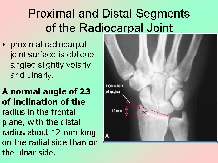 Proximal and Distal Segments of the Radiocarpal Joint • proximal radiocarpal joint surface is