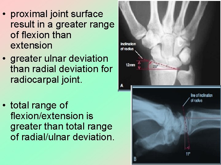  • proximal joint surface result in a greater range of flexion than extension