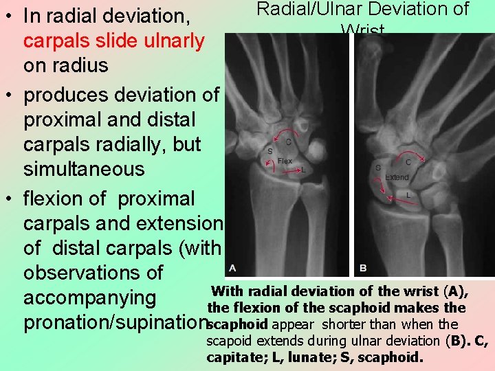 Radial/Ulnar Deviation of • In radial deviation, Wrist carpals slide ulnarly on radius •