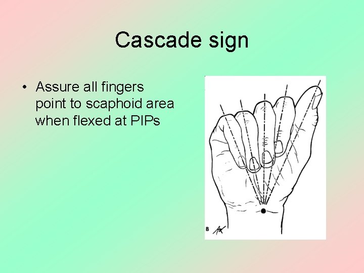 Cascade sign • Assure all fingers point to scaphoid area when flexed at PIPs