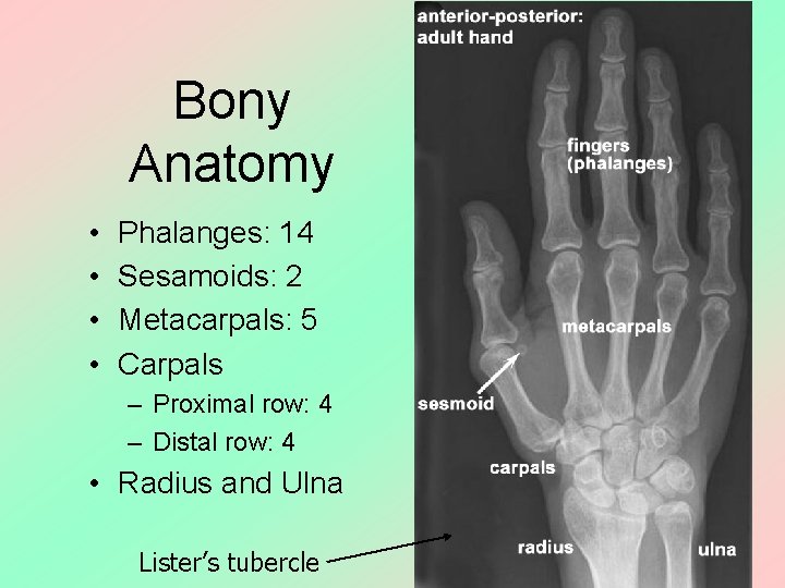 Bony Anatomy • • Phalanges: 14 Sesamoids: 2 Metacarpals: 5 Carpals – Proximal row: