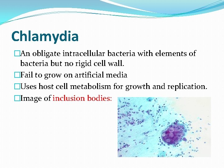 Chlamydia �An obligate intracellular bacteria with elements of bacteria but no rigid cell wall.