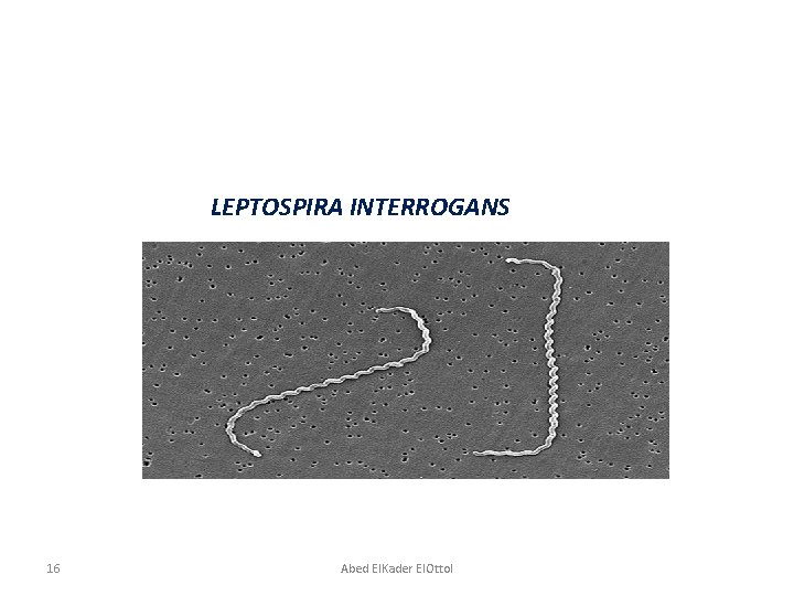 LEPTOSPIRA INTERROGANS 16 Abed El. Kader El. Ottol 