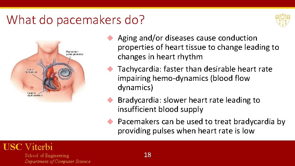 What do pacemakers do? Aging and/or diseases cause conduction properties of heart tissue to