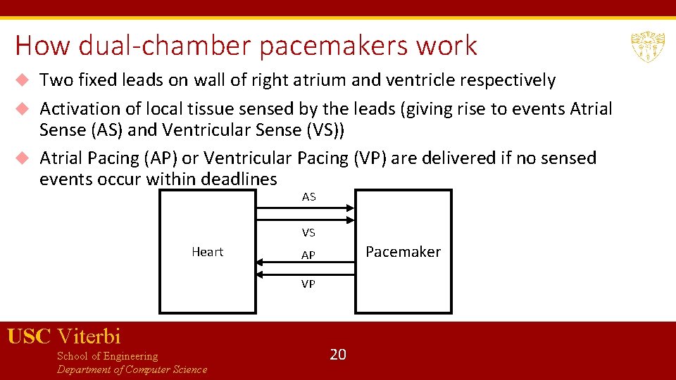 How dual-chamber pacemakers work Two fixed leads on wall of right atrium and ventricle