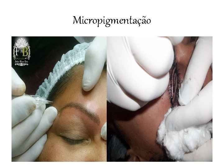 Micropigmentação 