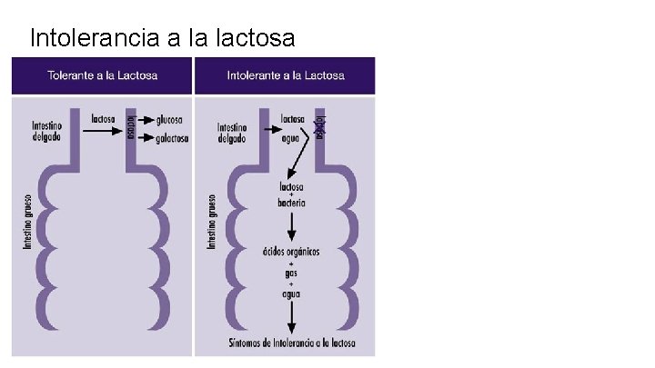 Intolerancia a la lactosa 