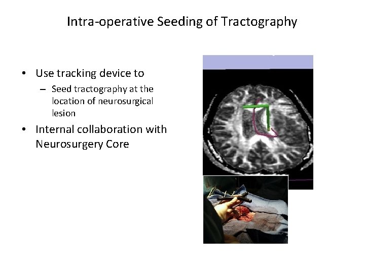 Intra-operative Seeding of Tractography • Use tracking device to – Seed tractography at the