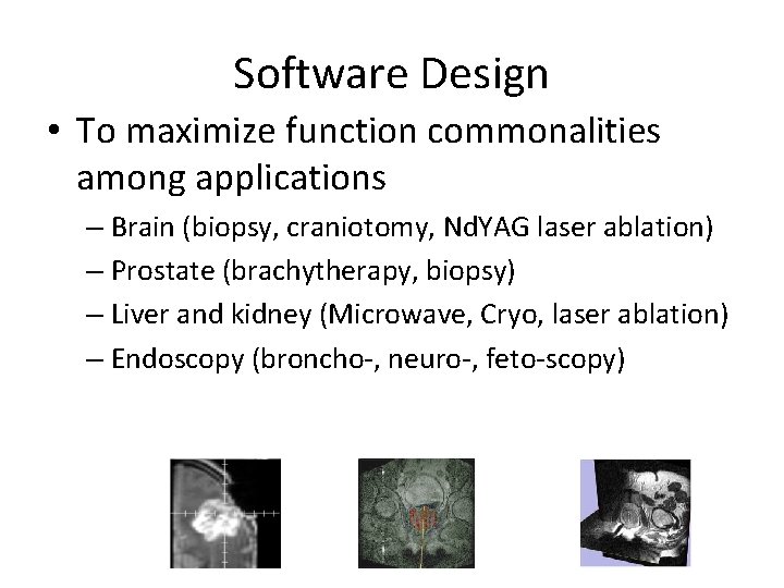 Software Design • To maximize function commonalities among applications – Brain (biopsy, craniotomy, Nd.