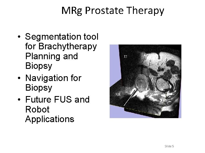 MRg Prostate Therapy • Segmentation tool for Brachytherapy Planning and Biopsy • Navigation for