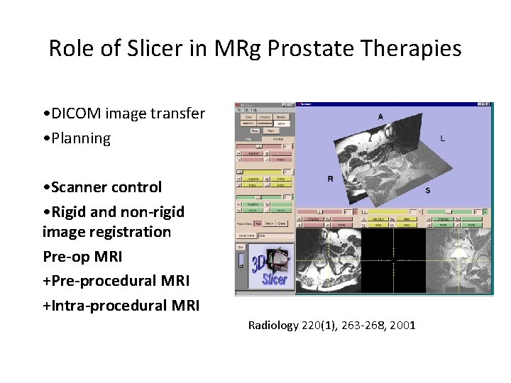 Role of Slicer in MRg Prostate Therapies • DICOM image transfer • Planning •