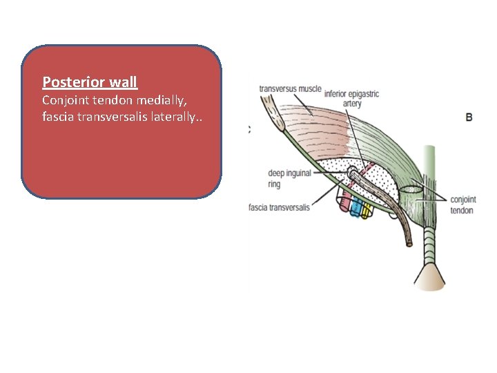 Posterior wall Conjoint tendon medially, fascia transversalis laterally. . 