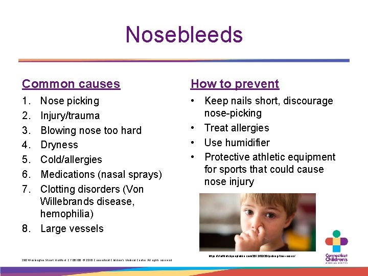 Nosebleeds Common causes How to prevent 1. 2. 3. 4. 5. 6. 7. •