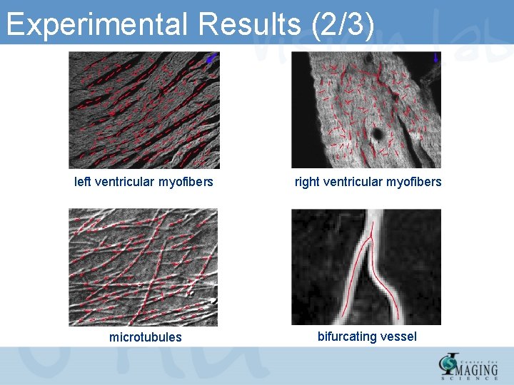 Experimental Results (2/3) left ventricular myofibers right ventricular myofibers microtubules bifurcating vessel 