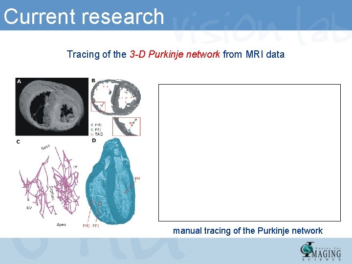 Current research Tracing of the 3 -D Purkinje network from MRI data manual tracing