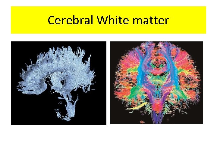 Cerebral White matter 