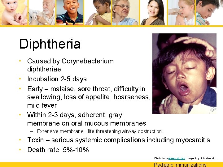 Diphtheria • Caused by Corynebacterium diphtheriae • Incubation 2 -5 days • Early –