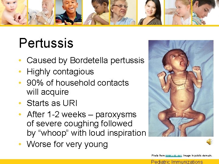 Pertussis • Caused by Bordetella pertussis • Highly contagious • 90% of household contacts