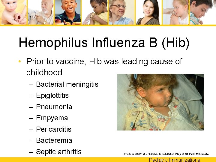 Hemophilus Influenza B (Hib) • Prior to vaccine, Hib was leading cause of childhood