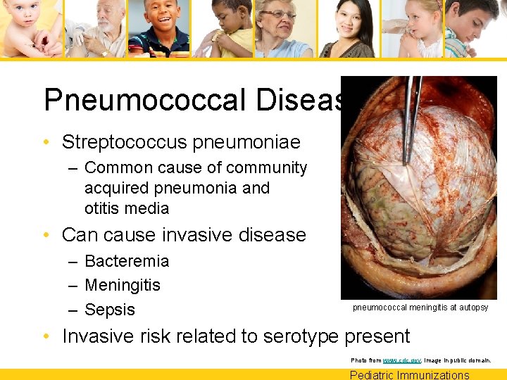 Pneumococcal Disease • Streptococcus pneumoniae – Common cause of community acquired pneumonia and otitis