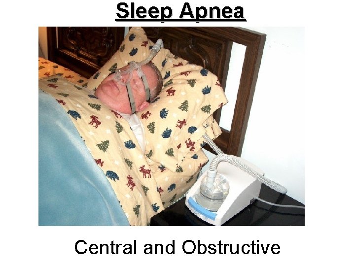 Sleep Apnea Central and Obstructive 