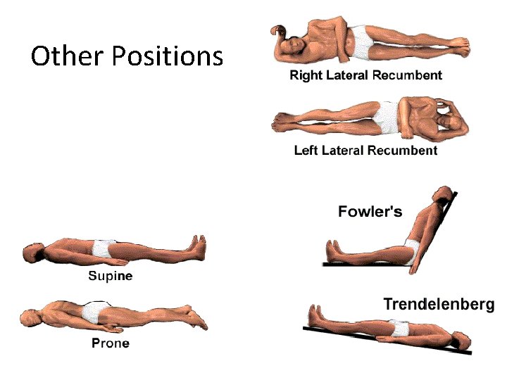 Other Positions 