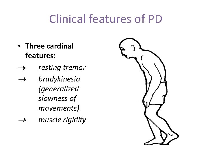 Clinical features of PD • Three cardinal features: ® resting tremor ® bradykinesia (generalized